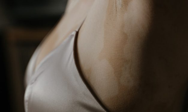 Que faire avant une épilation définitive au laser ?