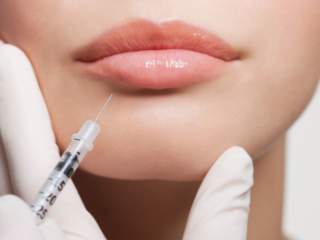 Acide hyaluronique lèvres : quels sont les bienfaits pour une bouche naturellement sublimée ?