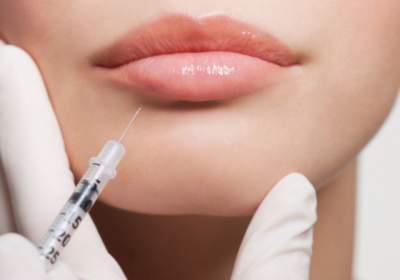Acide hyaluronique lèvres : quels sont les bienfaits pour une bouche naturellement sublimée ?